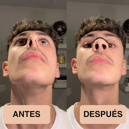 Respira libre - Kit AirFlow